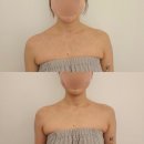 승진셀프세차장 | [인천 청라] 금손테라피 | 가정동 루원시티 윤곽관리, 승모근관리 찐 추천 후기