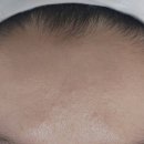 밝음메디 이미지