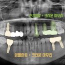 달서구청 우측 네이버블로그