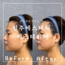 [진주피부관리] 진주시윤곽관리 피부관리샵 추천 ! 진주 에스테티아