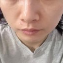 생생후기 속건조 탈출! 전주 제이뷰티에서 찾은 피부관리 비법