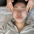 올핸드피스 주식회사 | 언주역 피부과 튠페이스 리프팅 당일 2주차 관리