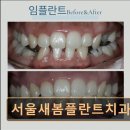 서울새봄플란트치과의원 이미지