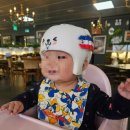 세븐일레븐광주기독병원점 | [생후9개월]두상교정/11-&gt;2.1/사두증/정상수치/광주기독병원/지오헬멧