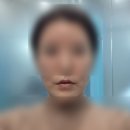 [내돈내산] 5세대스킨부스터 셀르디엠 후기 ｜입술필러+보톡스까지