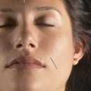 백초한의원 이미지