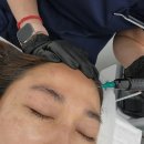 일산 식사동 피부관리 제이유뷰티 콜드플라즈마 후기