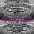 박경수치과의원 네이버블로그