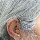 시그니아독일보청기도봉센터 이미지