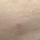 세라일론 수딩밤 내돈내산 5달 사용 솔직후기 사용꿀팁(ft.월간장영란)