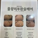 더원메디컬 | 새솔동 피부관리 추천 에스테틱단아 물광피부 솔직후기