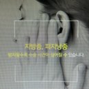 김해피지낭종지방종 방치하면 수술 시간이 더 오래 걸린다?