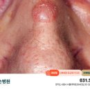 웰손병원 네이버블로그