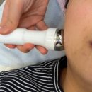 어등산약국 | 광주 수완지구 피부관리 수완지구 여드름 모공 관리 세이뷰티에서 모공클리닉 받고 온 후기