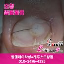오창발톱통증 내성발톱 4년째 방문중인 찐단골 후기