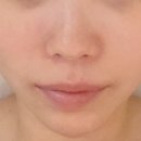 보테에스테틱 이미지