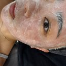 달성2차서로 | 대구 다사웨딩피부관리 "오피뉴에스테틱" 알테온리프팅 후기!