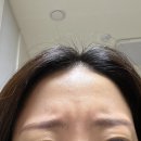 (주)미희 | 신논현피부과 주름보톡스와 미희주사 솔직후기