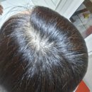 헤어닥터 | 닥터포헤어 폴리젠샴푸 내돈내산 후기