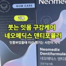 메딕스 | 잇몸부었을때 안팎으로 챙기는 네오메딕스 덴티포뮬러 솔직 후기