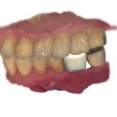 라이브치과기공소 이미지