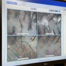 모코드두피탈모센터 | 안양 두피관리 잘하는 곳 모코드두피탈모센터 프리미엄 케어 후기