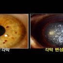 아이앤유안경콘택트 헬스조선