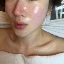 끌림 | 송도피부관리 진정 재생관리 더끌림스킨 솔직 후기