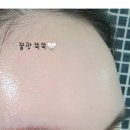 하라셀 밀크엑소좀, LDM 물방울리프팅 후기, 로우콥커피,첫인사 선물 이음청과, 옥산동카페 소디스...