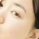 신논현 예쁨주의쁨의원 필로드 스킨부스터 후기! 리쥬란과 비교해본 솔직 리뷰
