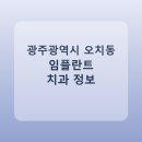 오제석치과의원 | 광주광역시 오치동 치과 임플란트 비교 가이드, 평균 가격부터 후기까지