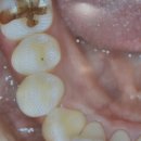 스마일강치과의원 이미지