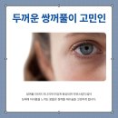 윤동주성형외과의원 네이버블로그
