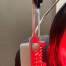 더봄치과기공소 | 대전 더봄치과에서 매복사랑니 뽑은 후기 (1편)