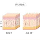 노원역필러 다시봄날의원에서 필러 시술 주기, 필러 전후, 시술 통증에 대해 알려드립니다.