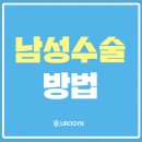 중앙비뇨기과의원 | 정왕동비뇨기과 남성수술 선택 전에 알아둘 점은