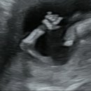 삼성린산부인과의원 이미지