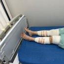 삼성바로하지의원 | 일산 하지정맥수술 삼성바로하지의원 고주파수술후기