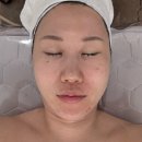 GS25대구국채보상로점 | [대구에스테틱]대구 중구 동인동 에스테틱 추천/이중턱, 팔자주름 고민일때 &lt;렛미인 dearrest&gt;