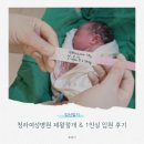 (주)팔팔팔에프앤씨 | [임신일기] 청라여성병원 유도분만 제왕절개 후기