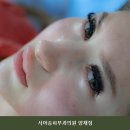서아송피부과의원 네이버블로그