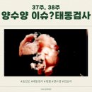 태동 | 37주, 38주 양수양 이슈? 태동검사 / 진료비 후기