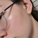 에피오네 | 피부과 관리만? No No! 이너뷰티 필수인 이유, ECM.E 에피오네 먹는 히알루론산 솔직후기