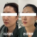 아미뷰티(AMI BEAUTY) | 대구 피부관리 교대역 효과 좋은 무통 리프팅 아미뷰티센터