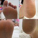 태이랩 | 인천발관리 발각질 제거 레푸스 구월점 방문후기