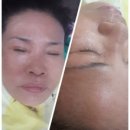 이명헤어 네이버블로그