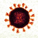 중증급성호흡기증후군 (Severe Acute Respiratory Syndrome, SARS) 이미지