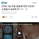 [단독] 3살 아들 얼굴에 박힌 다트핀…쇼핑몰서 날벼락 이미지