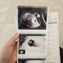 아산시보건소 | [임신]임신테스트기 두줄 2주 후 아기집 확인, 아산시보건소 임산부 산모등록, 산모검사, 선물 후기