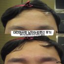 동안미남 완성! 숱없는 눈썹에 생명을 불어넣은 생생 대전남자눈썹문신 리뷰! 이미지